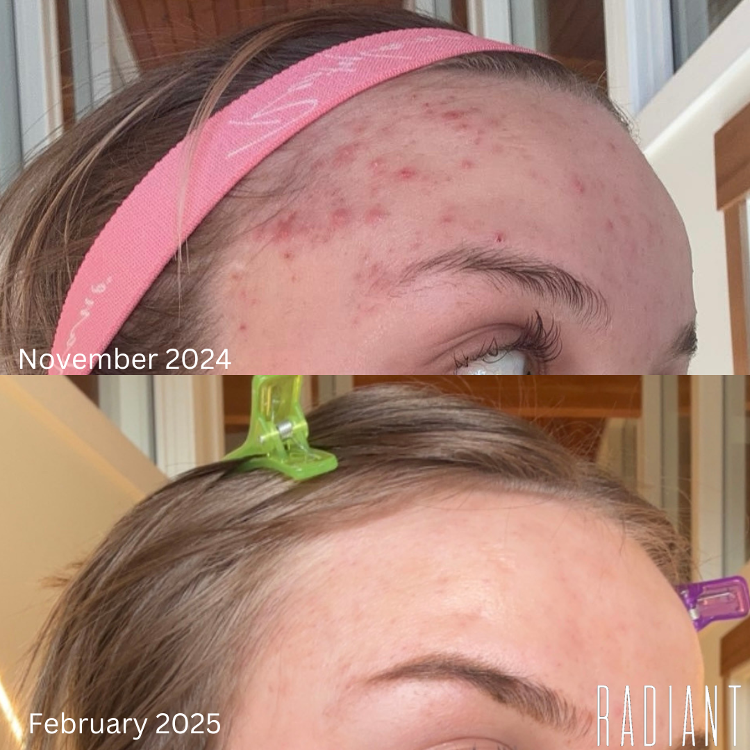 Reflection in the mirror. Woman looks in the mirror noticing the first wrinkles